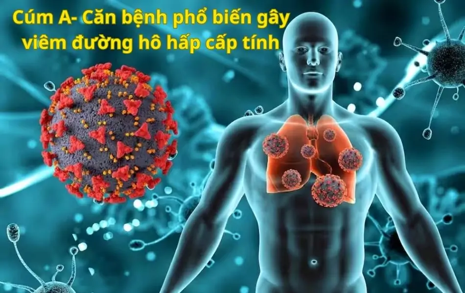 Dịch cúm - Bệnh gây viêm đường hô hấp cấp tính
